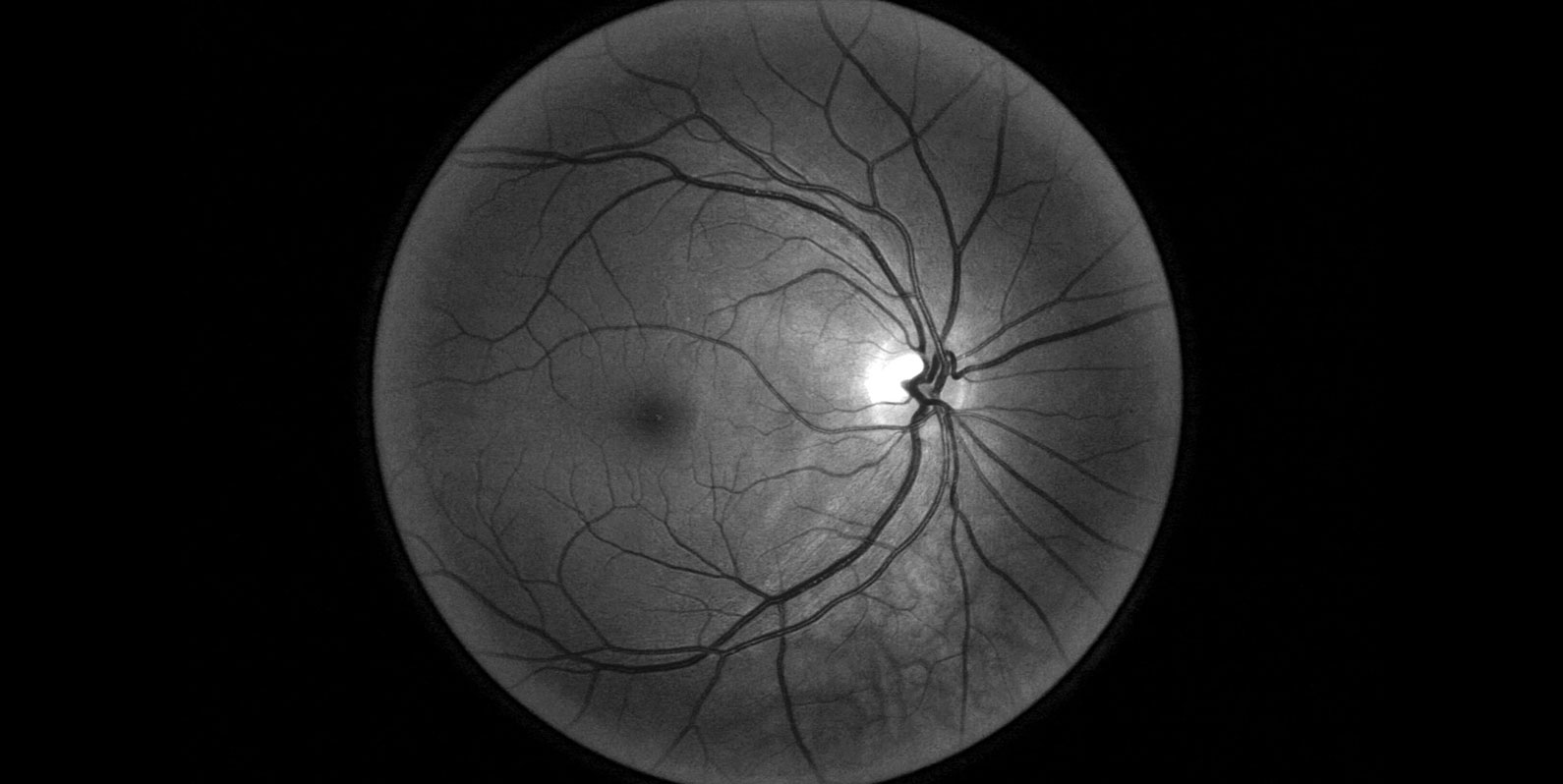 A Inteligência Artificial (IA) médica do Google foi supereficiente em laboratório. Na vida real, a história foi diferente