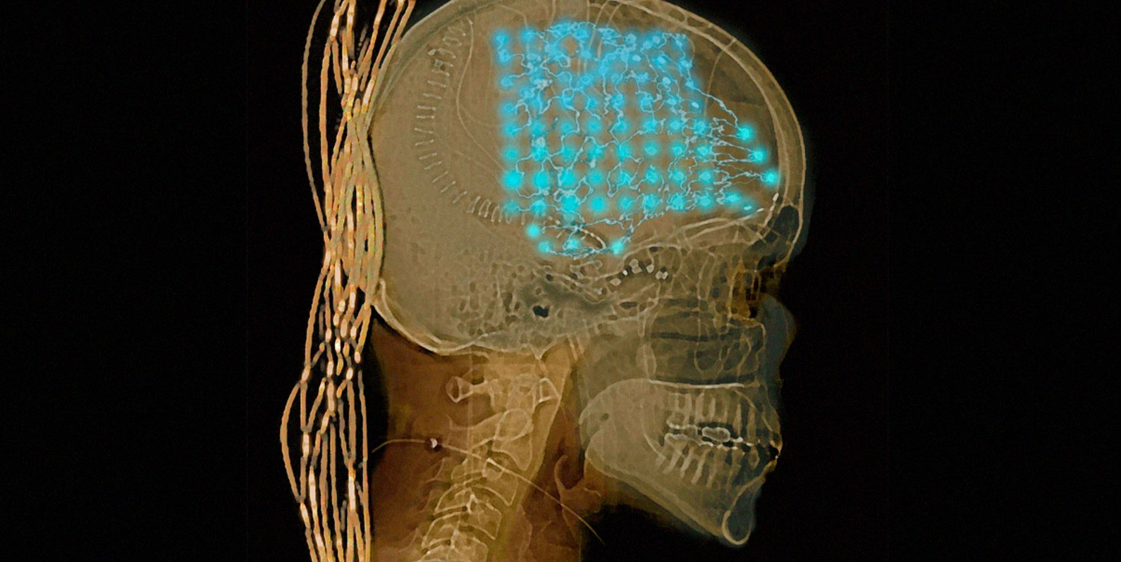 Neurocientistas ouviram o cérebro das pessoas por uma semana. Eles encontraram um pouco de ordem e um pouco de caos